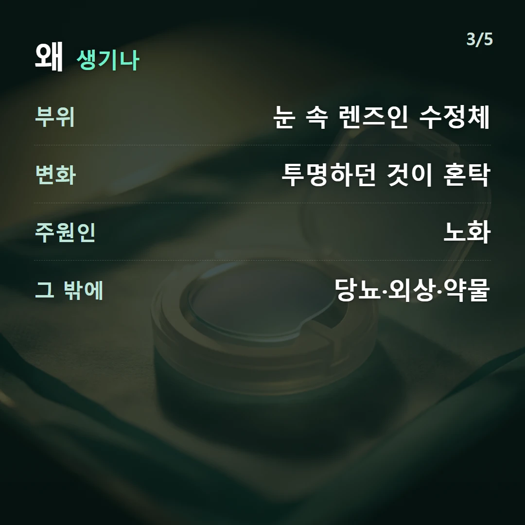 왜 생기나 — 부위 눈 속 렌즈인 수정체, 변화 투명하던 것이 혼탁, 주원인 노화, 그 밖에 당뇨·외상·약물