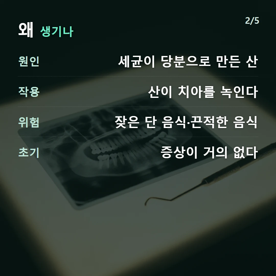 왜 생기나 — 원인 세균이 당분으로 만든 산, 작용 산이 치아를 녹인다, 위험 잦은 단 음식·끈적한 음식, 초기 증상이 거의 없다