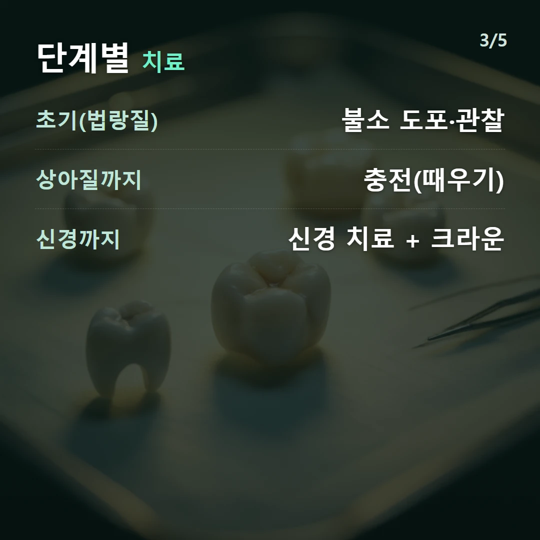 단계별 치료 — 초기(법랑질) 불소 도포·관찰, 상아질까지 충전(때우기), 신경까지 신경 치료 + 크라운