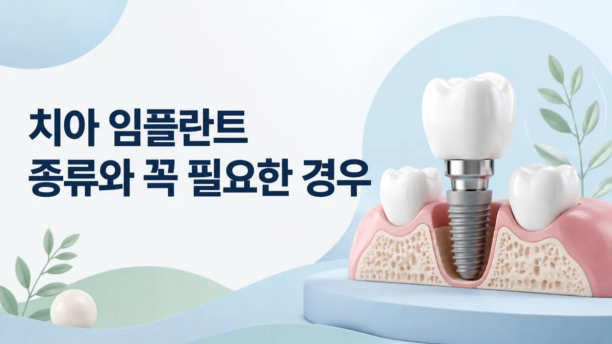 치아 임플란트 종류와 꼭 필요한 경우