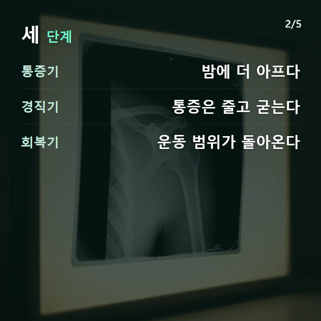 세 단계 — 통증기 밤에 더 아프다, 경직기 통증은 줄고 굳는다, 회복기 운동 범위가 돌아온다