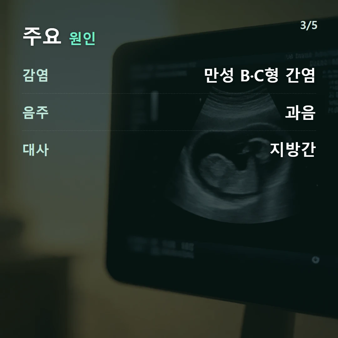 주요 원인 — 감염 만성 B·C형 간염, 음주 과음, 대사 지방간