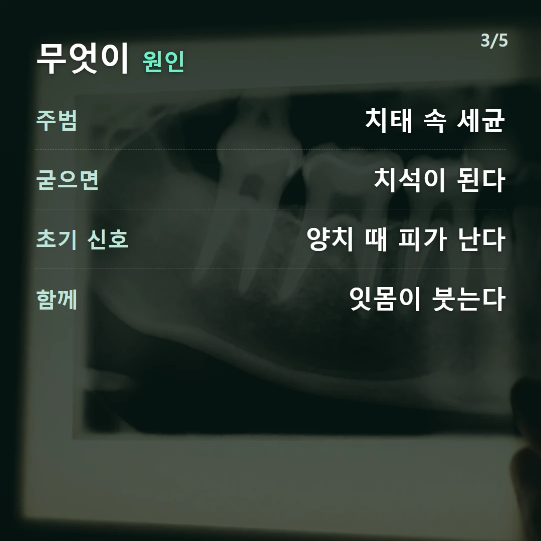 무엇이 원인 — 주범 치태 속 세균, 굳으면 치석이 된다, 초기 신호 양치 때 피가 난다, 함께 잇몸이 붓는다