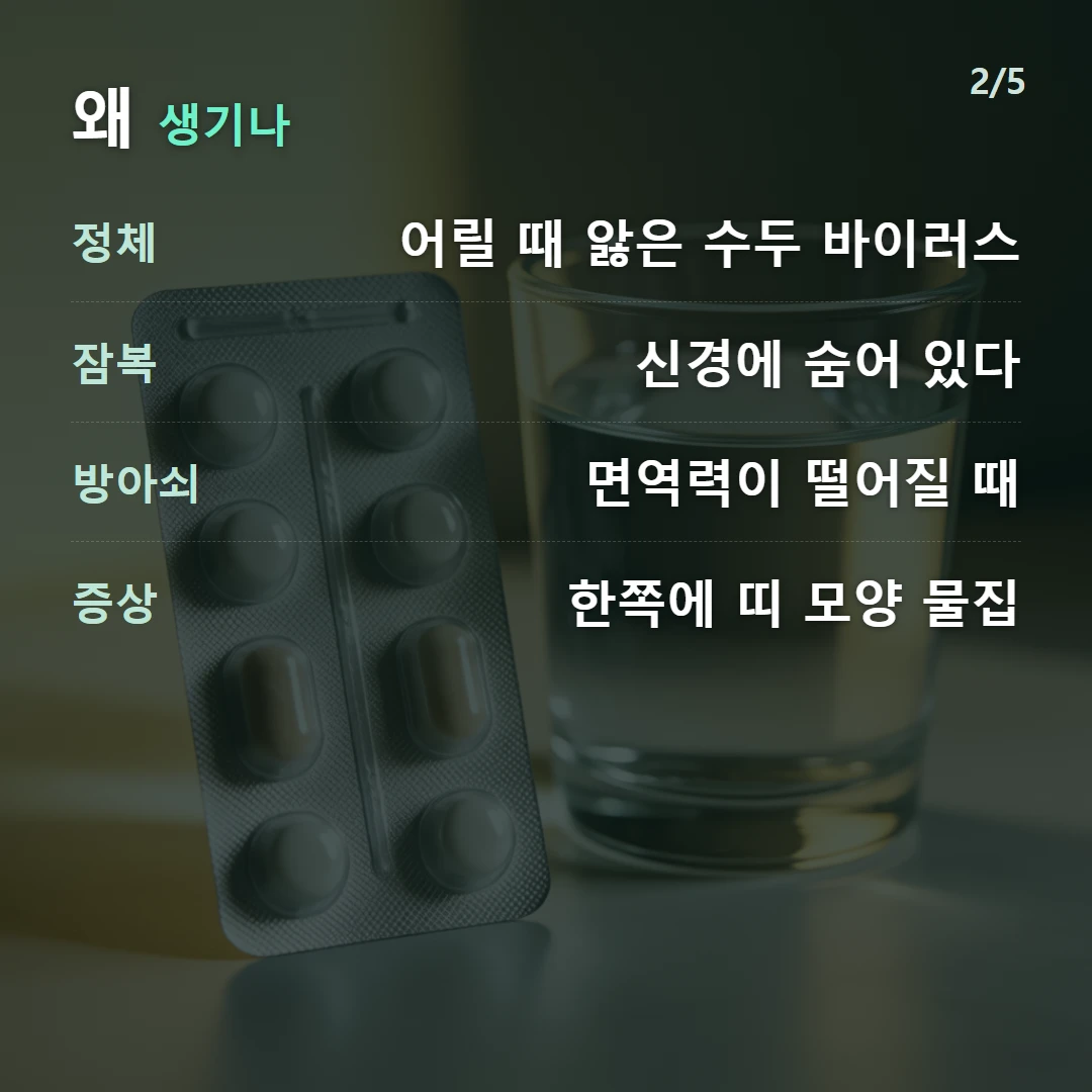 왜 생기나 — 정체 어릴 때 앓은 수두 바이러스, 잠복 신경에 숨어 있다, 방아쇠 면역력이 떨어질 때, 증상 한쪽에 띠 모양 물집